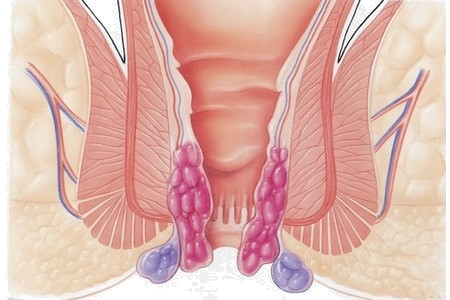 fig13 300FR