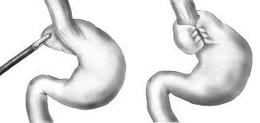 colon2